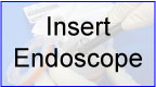 Endoscope Inserted